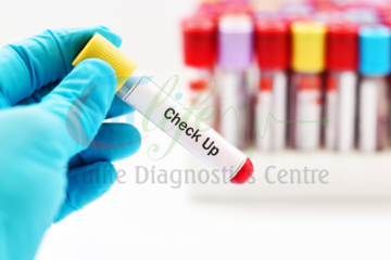 Blood tests and Lab tests