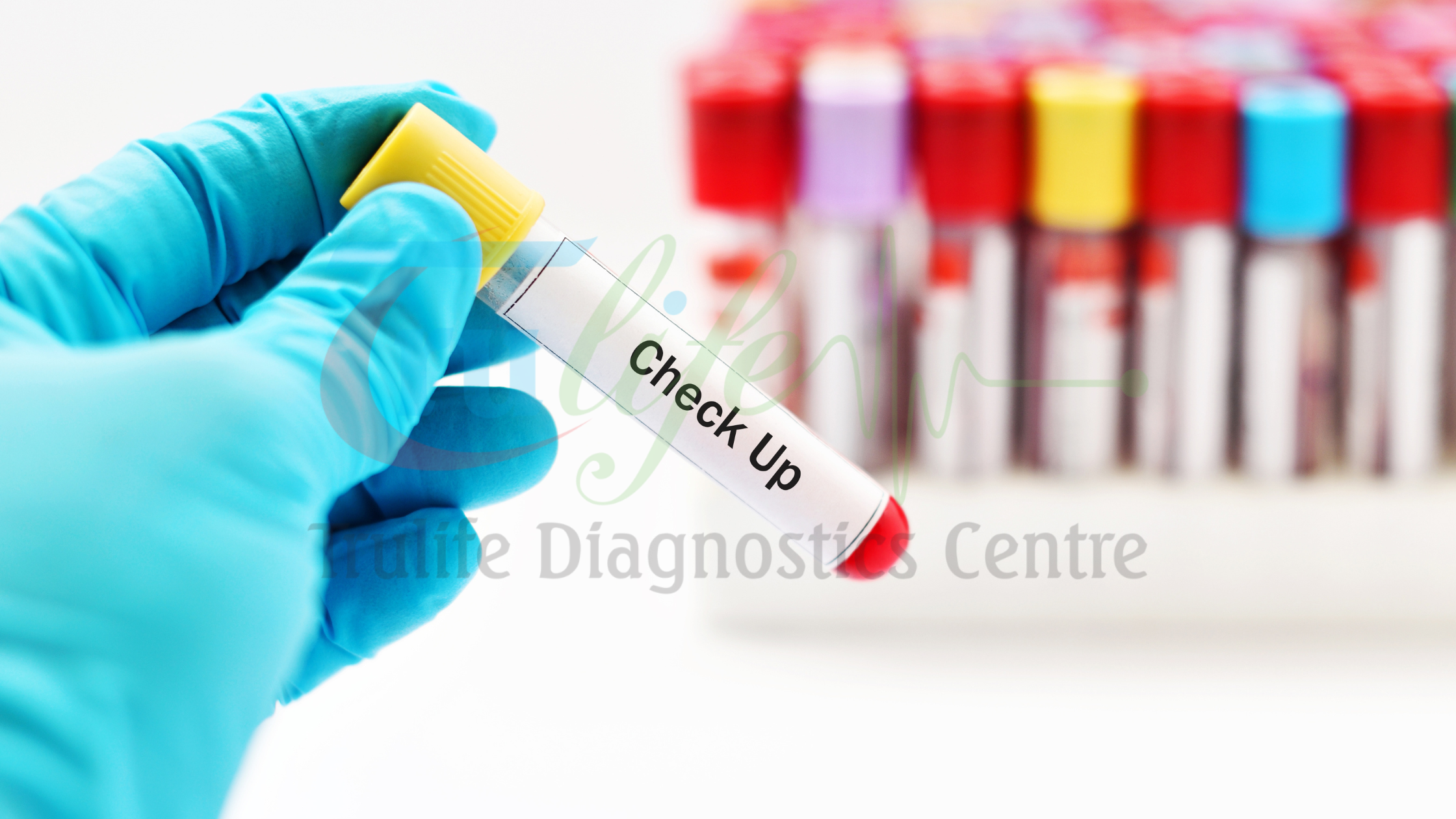 Blood tests and Lab tests