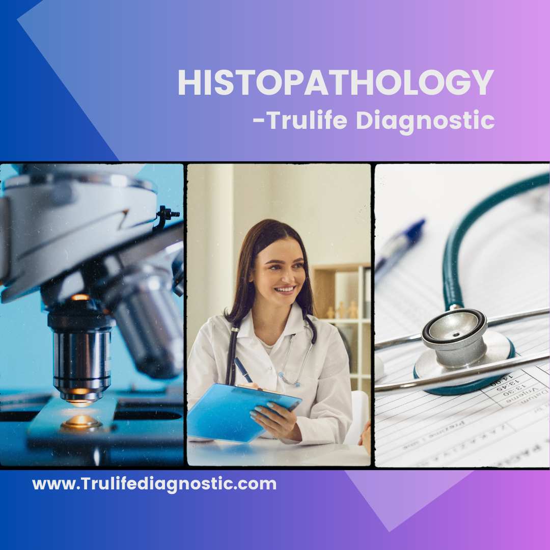 Best Histopathology -Biopsy Test in Hyderabad