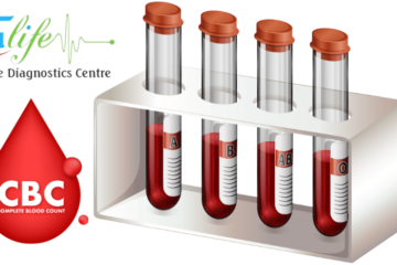 Book Blood Test At Home Visit Manikonda Hyderabad Trulife Diagnostic