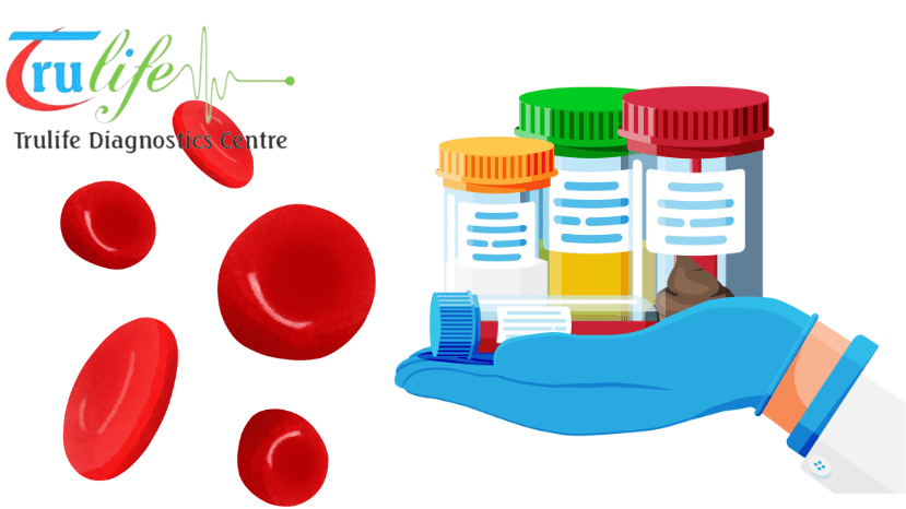 Book Blood Test At Home Visit Manikonda Hyderabad Trulife Diagnostic