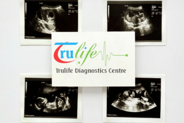 Early Pregnancy Scan Test In Manikunda