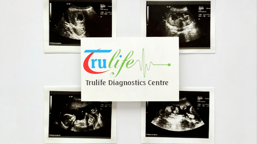 Early Pregnancy Scan Test In Manikunda