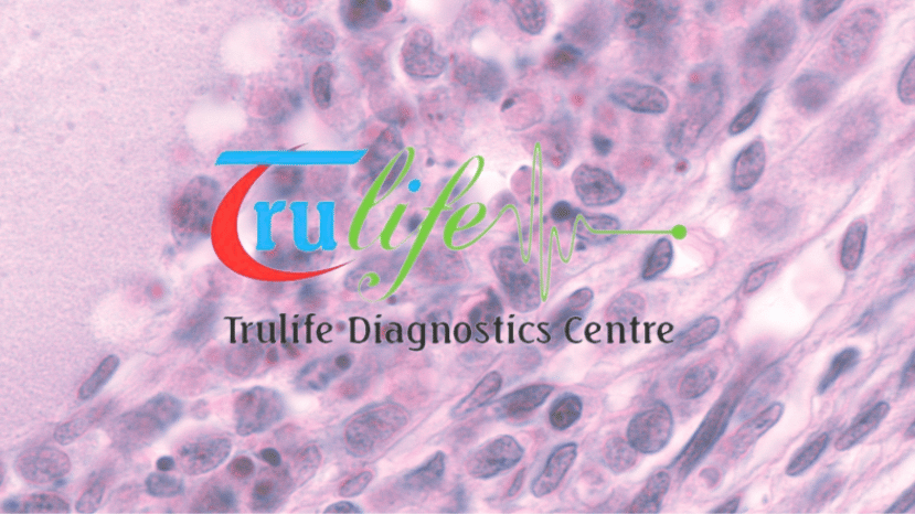 Follicular-Monitoring-Test-Centres-In-Ameerpet-Hyderabad-–-Trulife-Diagnostic