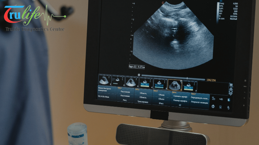 Ultrasound Test Centre In Narsingi Hyderabad | Trulife Diagnostic Centre