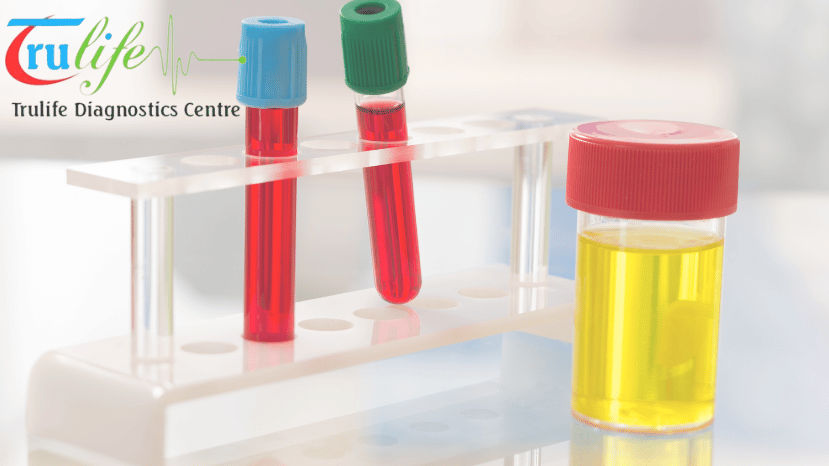 Healthcare at Your Convenience: Home Blood Tests in Suncity Hyderabad