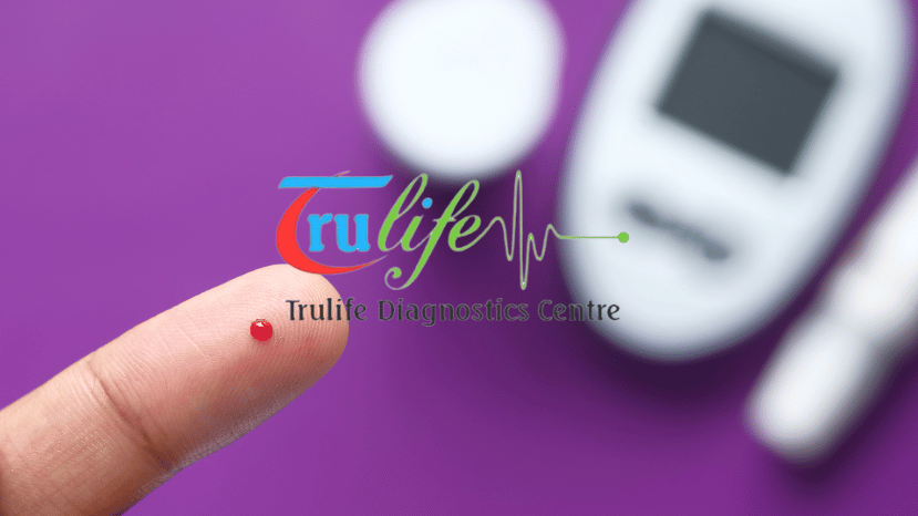 Book Blood Test At Home Manikonda Hyderabad Trulfie Diagnostic