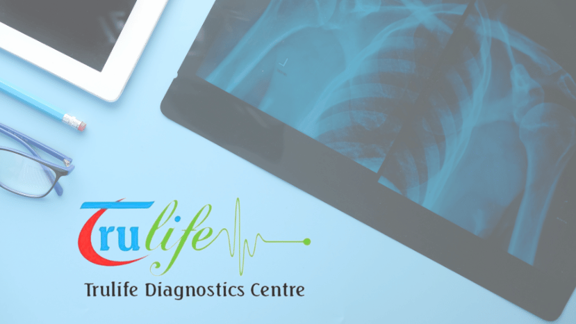 X-Rays in Narsingi Hyderabad Trulife Diagnostic