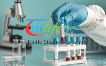 Blood Test In Narsingi Hyderabad Trulife Diagnostic