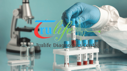 Blood Test In Narsingi Hyderabad Trulife Diagnostic