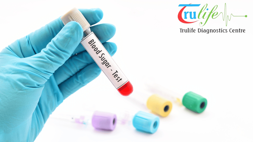 Blood Test In Narsingi Hyderabad Trulife Diagnostic