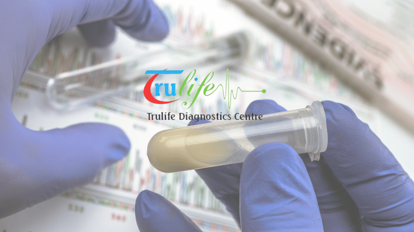 Semen Analysis at Trulife Diagnostic