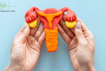 Follicular Monitoring in Ameerpet