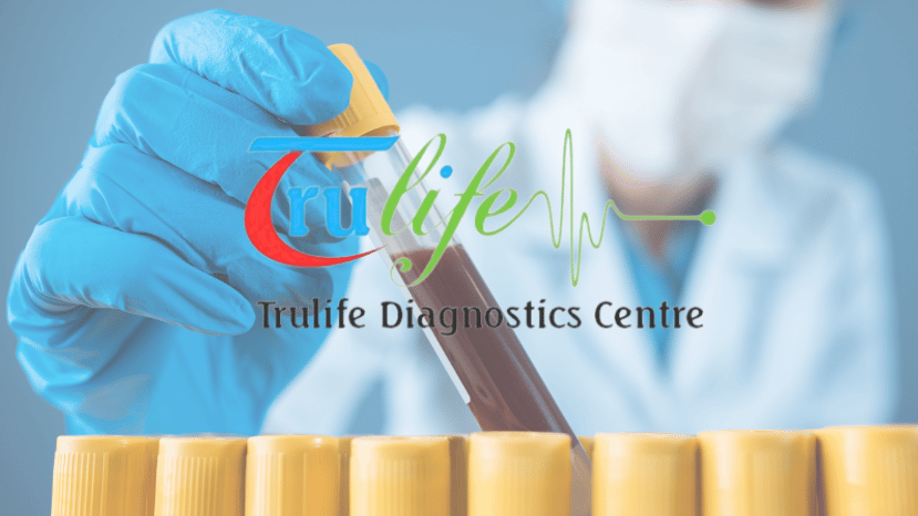 Seamless Convenience with Trulife Diagnostic Easy Access to Blood Testing and Diagnostic Services in Hyderabad (2)