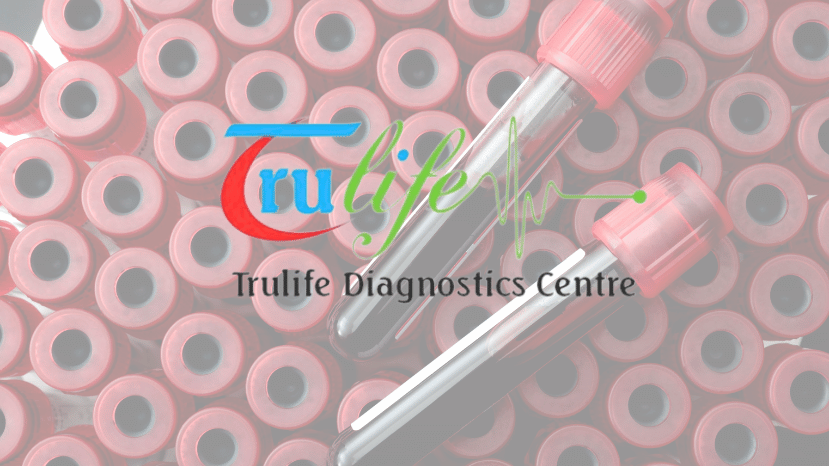 Access Precise Blood Testing Effortlessly in Hyderabad with Trulife Diagnostic