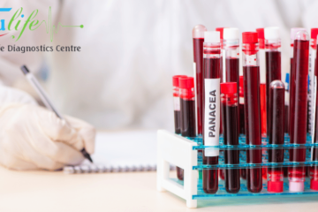 Seamless Convenience with Trulife Diagnostic Easy Access to Blood Testing and Diagnostic Services in Hyderabad (1)