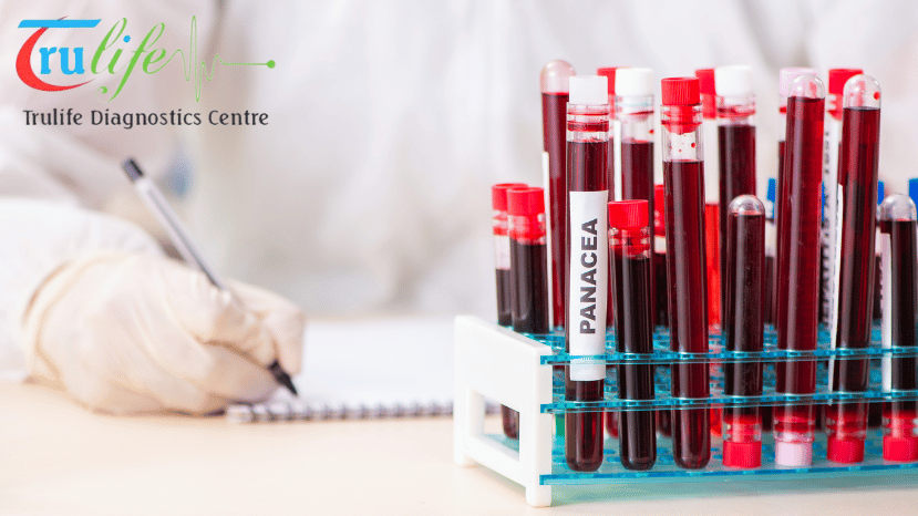 Seamless Convenience with Trulife Diagnostic Easy Access to Blood Testing and Diagnostic Services in Hyderabad (1)