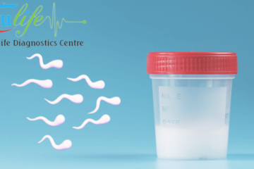 Expert Semen Analysis Services in Hyderabad Trulife Diagnostics (7)