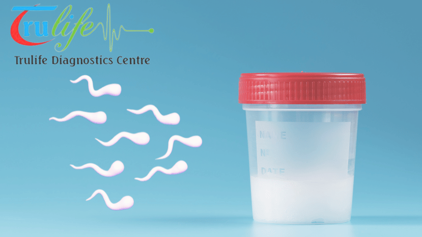 Expert Semen Analysis Services in Hyderabad Trulife Diagnostics (7)