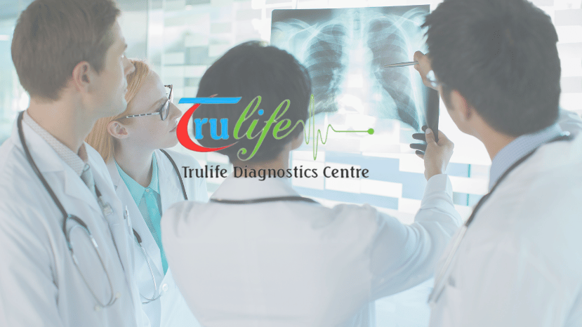 Digital X-ray Centers Near You in Hyderabad (Skeletal Survey) Trulife Diagnostic Offers 20% Off