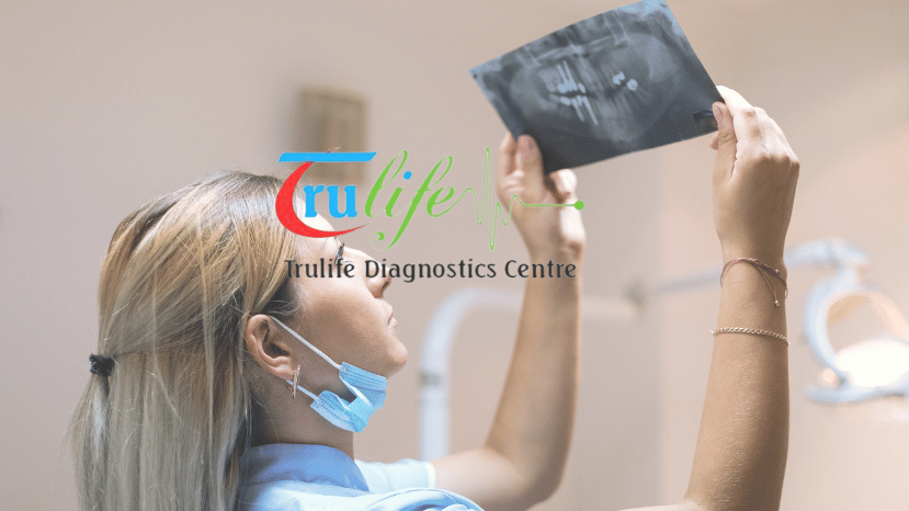 Digital X-ray Centers Near You in Hyderabad (Skeletal Survey) Trulife Diagnostic Offers 20% Off