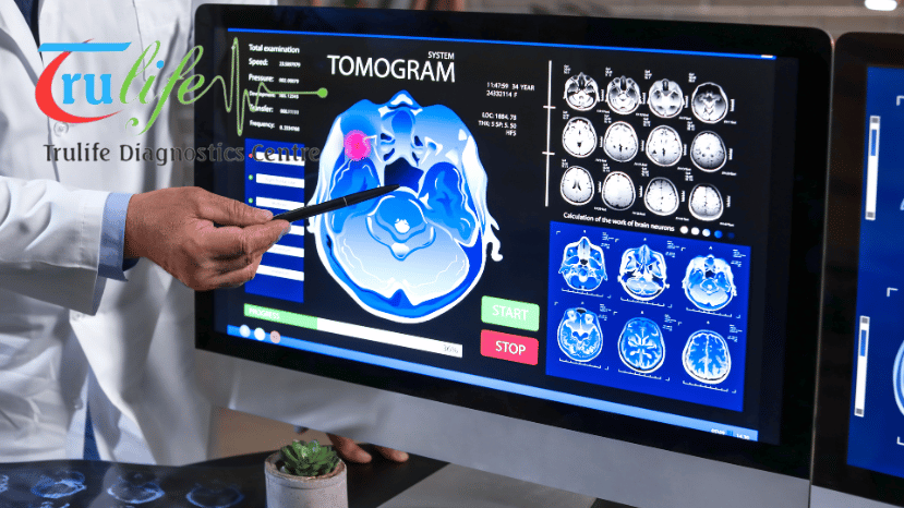 Trusted Ultrasound Scan Centre in Hyderabad Trulife Diagnostic