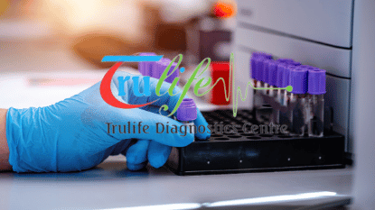 Trulife Diagnostic | Double Marker Test in Hyderabad at Low Cost - Book Online