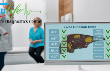 Kidney Function Test in Hyderabad