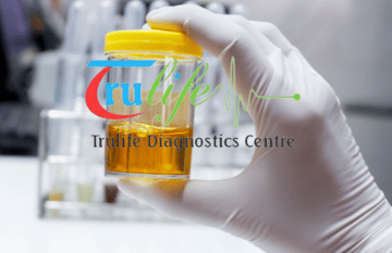 Book Urine Routine At Trulife Diagnostic In Delhi NCR