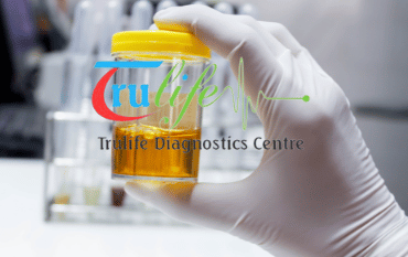 Book Urine Routine At Trulife Diagnostic In Delhi NCR