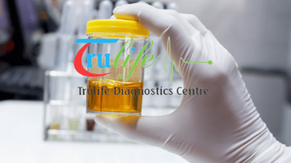 Book Urine Routine At Trulife Diagnostic In Delhi NCR