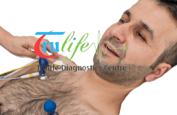 ECG Test prices starting at Rs 149 in Hyderabad | Trulife Diagnostic