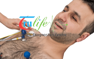 ECG Test prices starting at Rs 149 in Hyderabad | Trulife Diagnostic