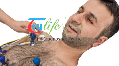 ECG Test prices starting at Rs 149 in Hyderabad | Trulife Diagnostic