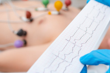 ECG in Narsingi