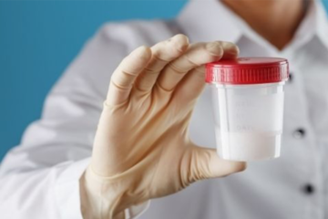 Semen Analysis in Narsingi