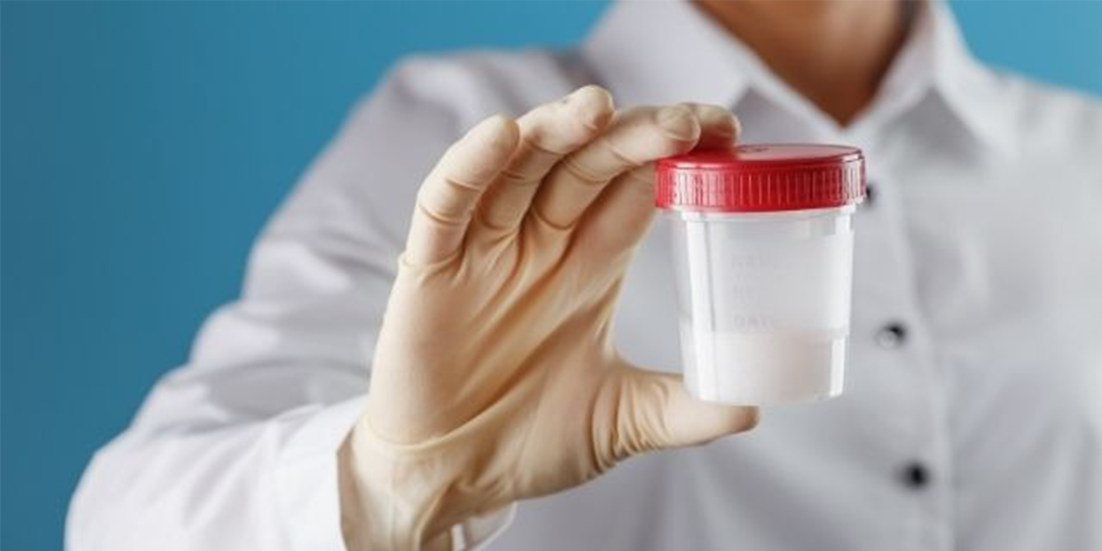 Semen Analysis in Narsingi