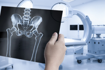 digital x ray in hyderabad