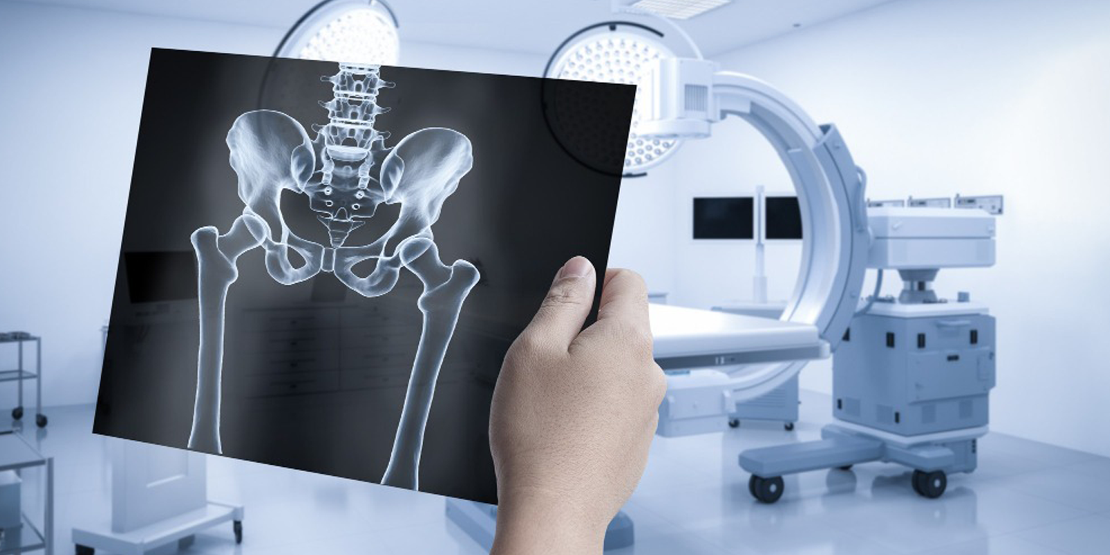 digital x ray in hyderabad