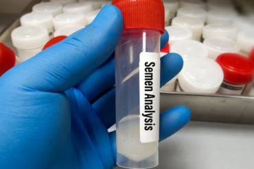 Semen Analysis