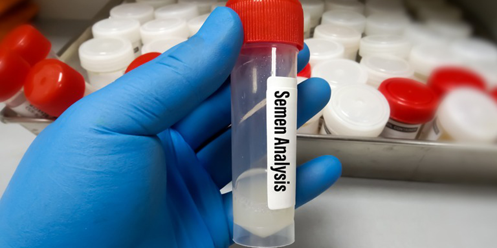 Semen Analysis