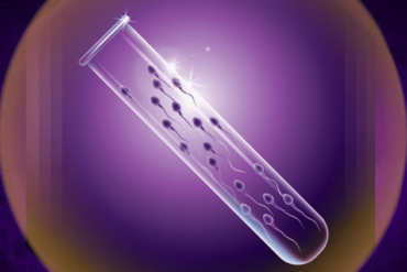 Semen Analysis