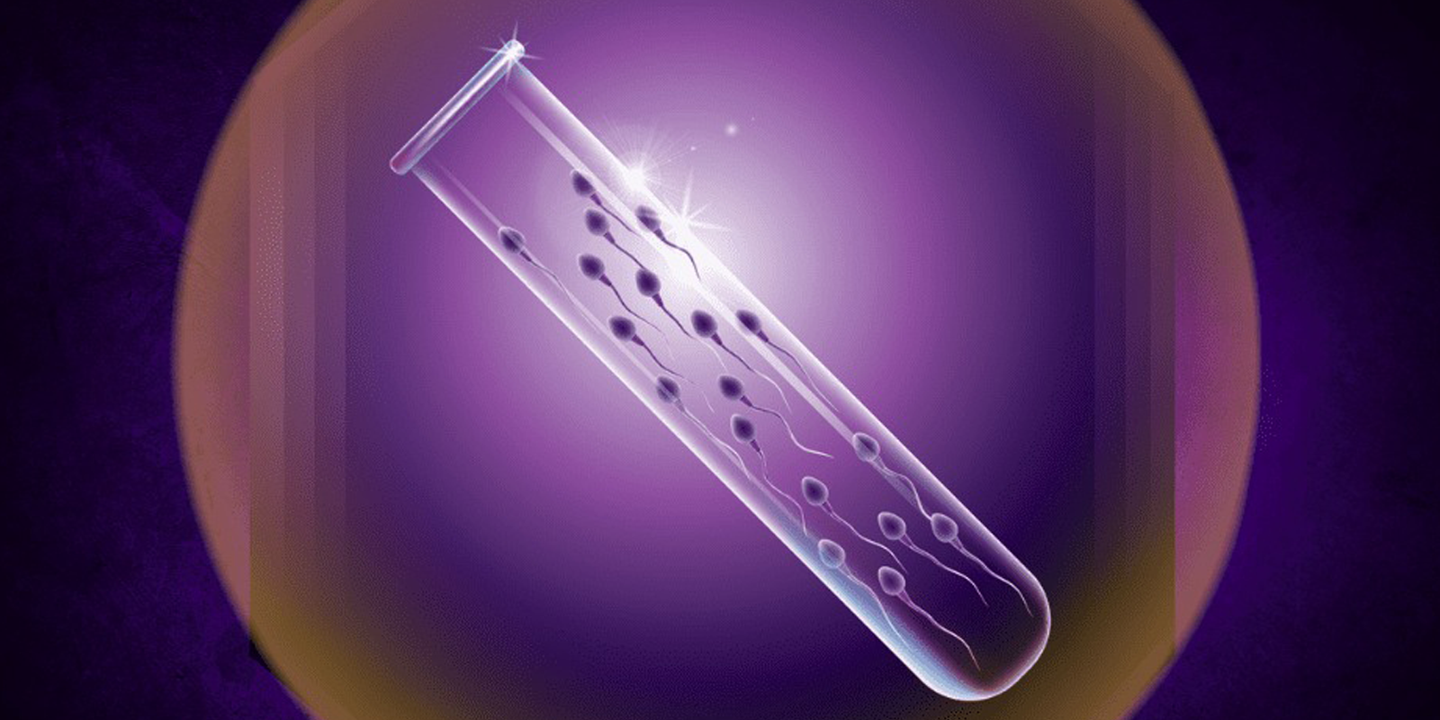 Semen Analysis