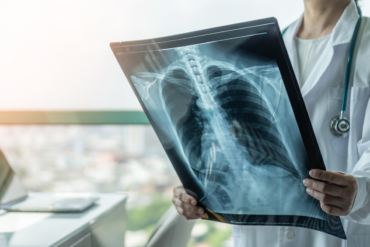 Digital X-Ray in Hyderabad