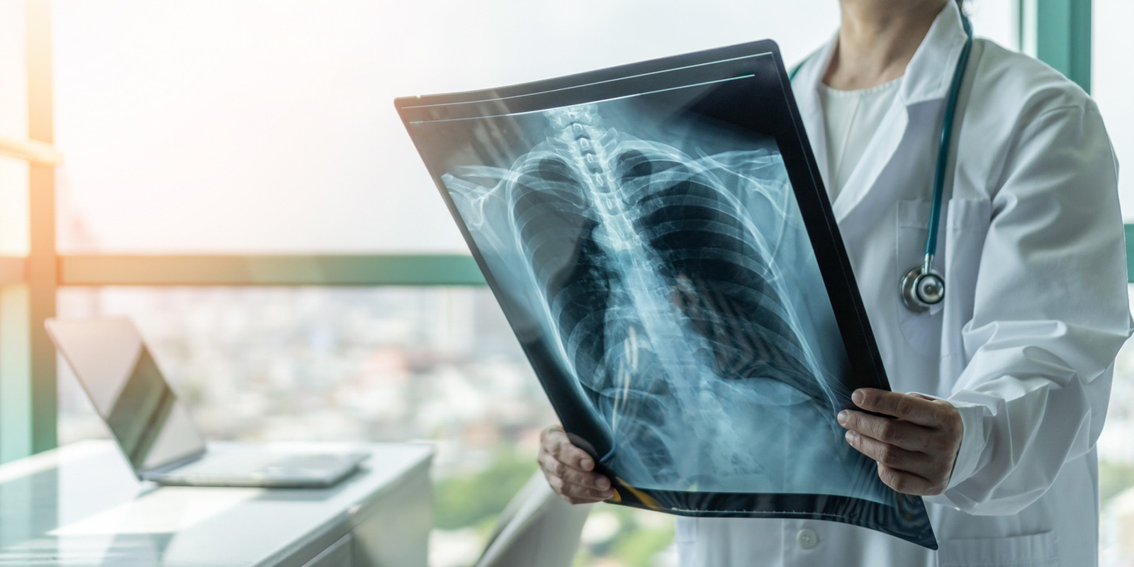 Digital X-Ray in Hyderabad