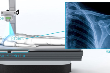 digital x-ray in hyderabad