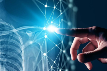 digital x ray in Hyderabad