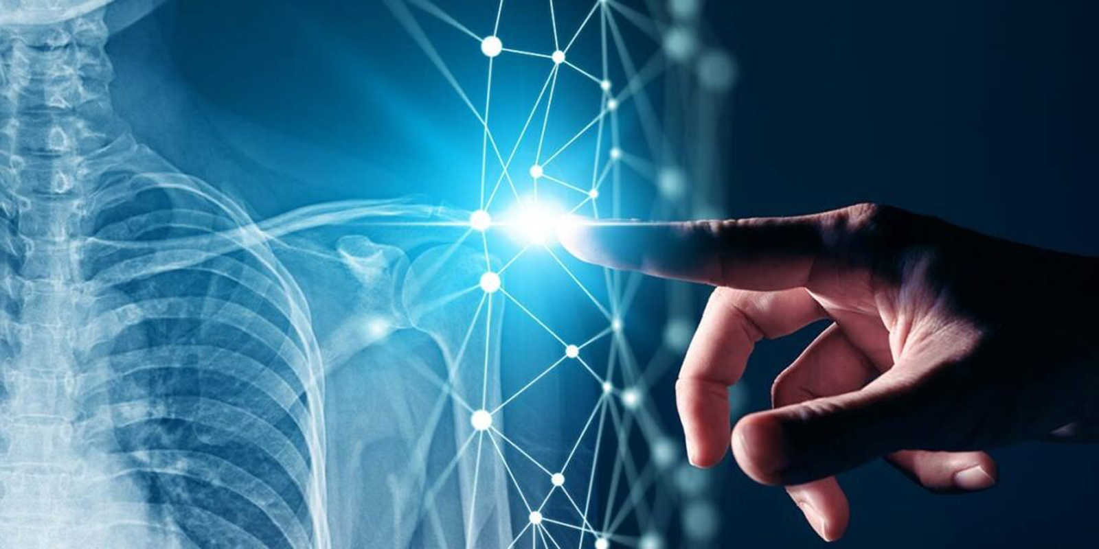 digital x ray in Hyderabad