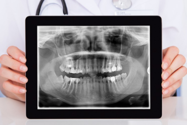 digital x ray in hyderabad