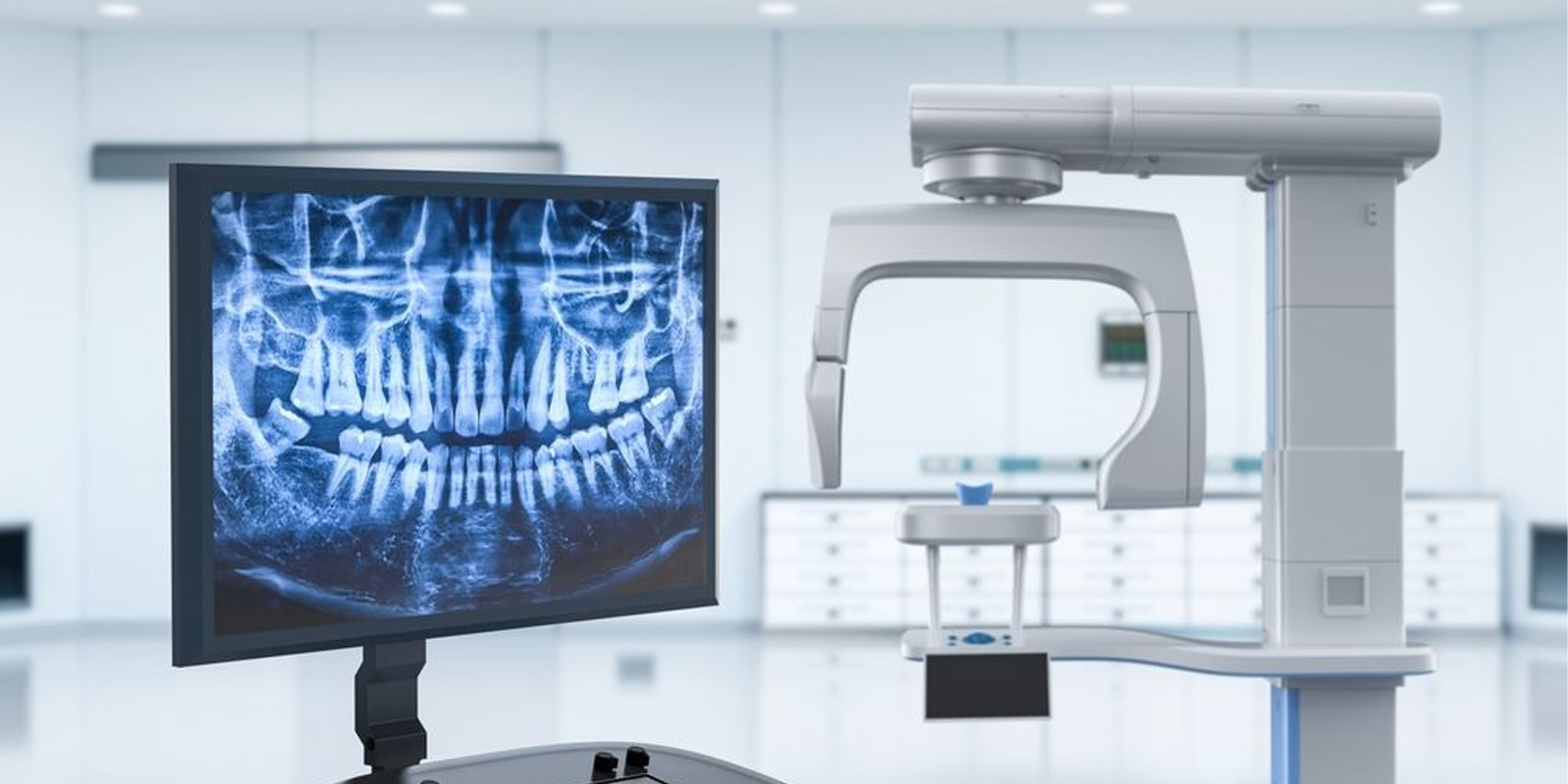 digital x ray in hyderabad